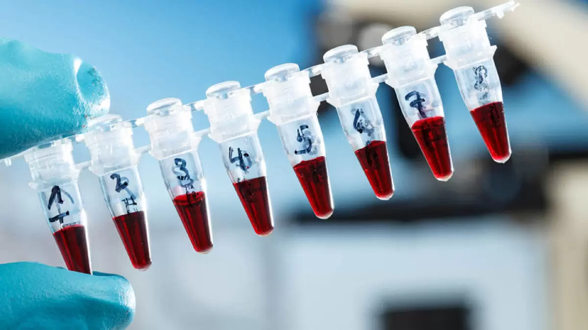 Daftar 742 Lab Tes PCR Syarat Naik Pesawat Selama PPKM Darurat